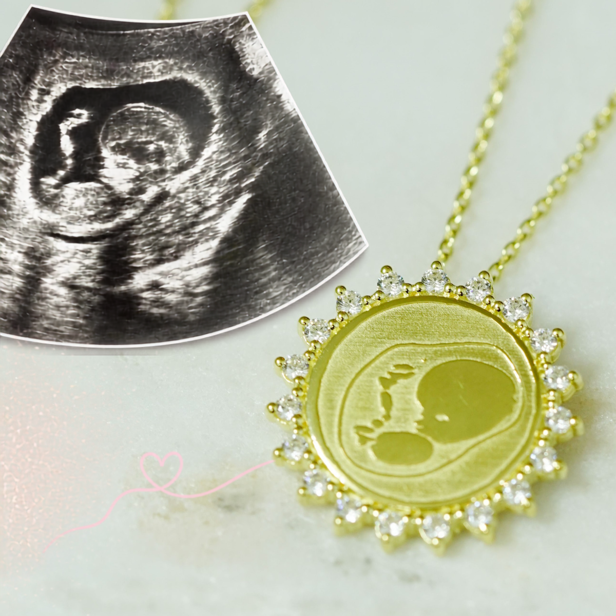All she had was an ultrasound